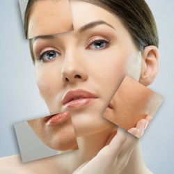 Как улучшить состояние кожи?